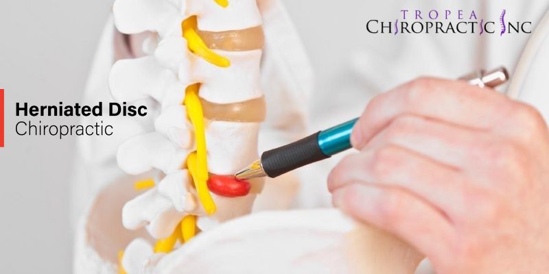 Find herniated disc chiropractic care near me